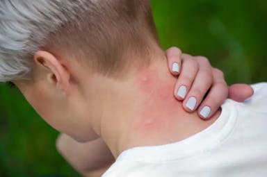 Läs vårt test om: Bästa myggfångaren Bästa myggfångaren Bäst i test